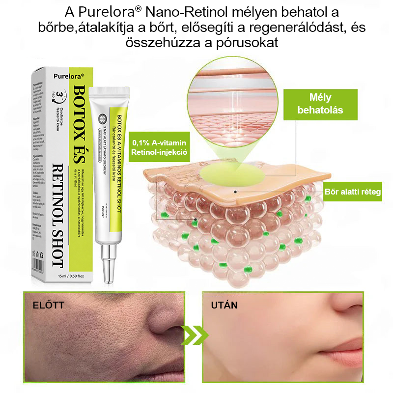 [🔥Utolsó nap 70% kedvezmény] Purelora® Botox és Retinol injekció - Radír mély ráncokra, megereszkedett toka és duzzadt szemek ellen