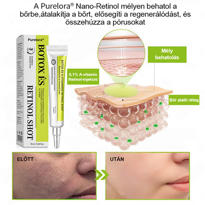 [🔥Utolsó nap 70% kedvezmény] Purelora® Botox és Retinol injekció - Radír mély ráncokra, megereszkedett toka és duzzadt szemek ellen