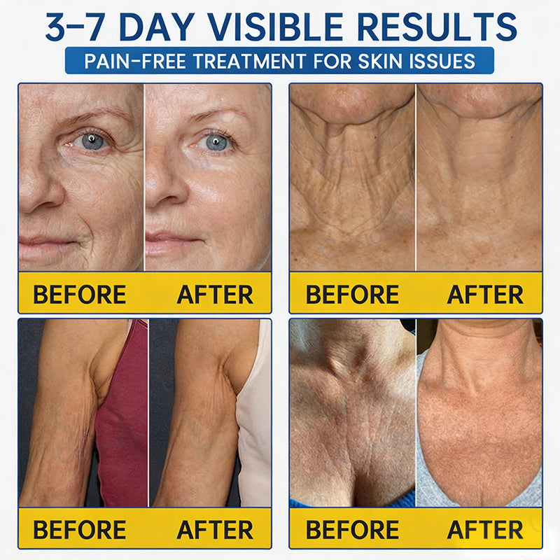 🥈🧡🧶Curalona® Botox & PDRN Anti-Wrinkle Shot – Lift & Firming Cream