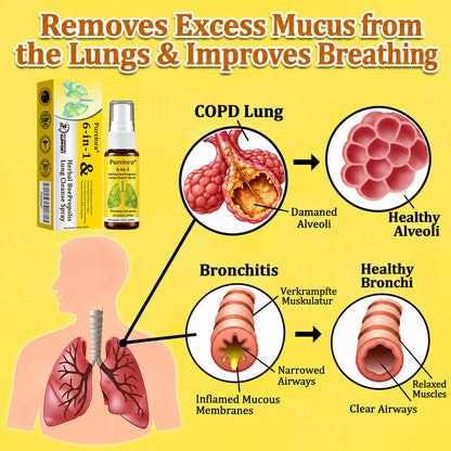 🍀🍀🐝🇦🇺 Official Store:𝐏𝐔𝐑𝐄𝐋𝐎𝐑𝐀®  6-in-1 Herbal BeePropolis Lung Cleanse Spray（👨‍⚕️Directly acts on COPD, asthma, chronic bronchitis (CB), respiratory infections, lung cancer, sinusitis, and other conditions🫁）
