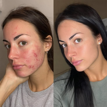 💖【Hivatalos áruház】PURELORA® AdaptaShade alapozó ——Bőrápoló hatású, színadaptáló alapozó