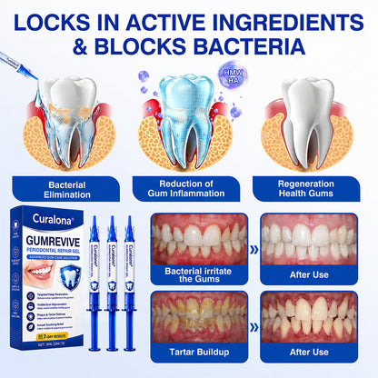 🇦🇺🦷Curalona® GumRevive Periodontal Repair Gel (For Bleeding Gums, Gum Recession & Loose Teeth)+ 🎁 FREE Gum Care Kit
