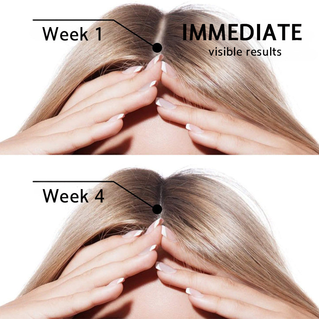 🌿👨‍⚕️ Official Australian Flagship Store 🇦🇺 | 🔥PURELORA® Onion & Rosemary 2-in-1 Anti-Hair Loss & Growth Set — Infused with a 15x concentrated hair-growth active complex to help you achieve thicker, fuller, and stronger hair.