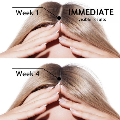 🌿👨‍⚕️ Official Australian Flagship Store 🇦🇺 | 🔥PURELORA® Onion & Rosemary 2-in-1 Anti-Hair Loss & Growth Set — Infused with a 15x concentrated hair-growth active complex to help you achieve thicker, fuller, and stronger hair.