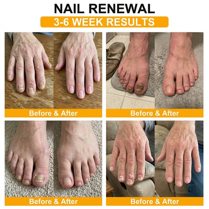 Purelora® Bee Venom Peptide Nail & Foot Repair Serum for nail fungus care, yellow nails, thick nails, and athlete’s foot recovery support.